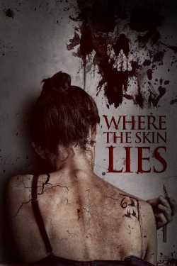 Where the Skin Lies-free